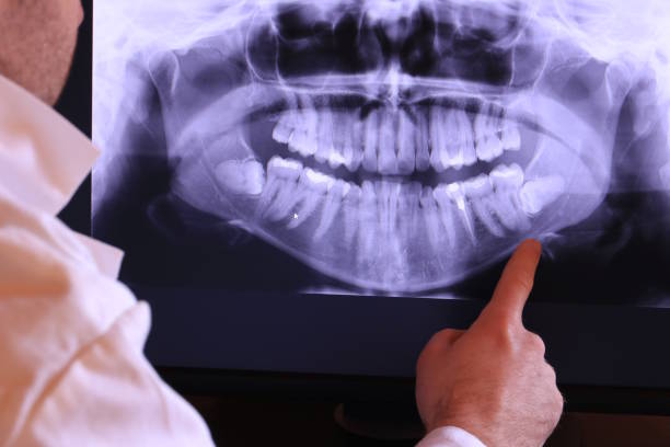 Best Emergency Root Canal Treatment in Carbondale, PA
